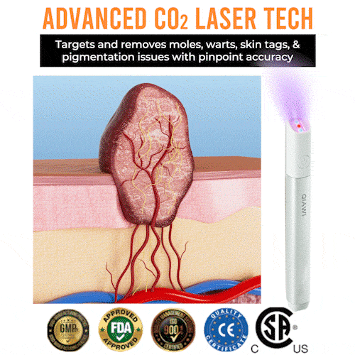 ✨QIAWI™ All-in-One CO₂ Laser Eraser Pen | Removes Moles, Warts, Skin Flaws & Pigmentation（fb）
