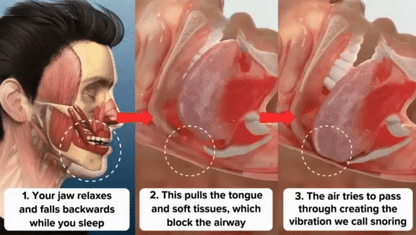 🔥✨PerfectSleep Solution- Anti-Snoring & Anti-Grinding Teeth Protector