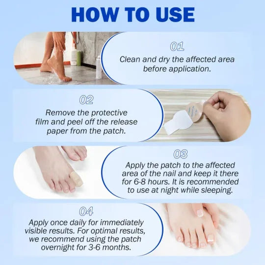 🦶 Fungal Nail Repair Patches (21 pcs/box)  Advanced Nail Health Care Solution for Fungal & Damaged Nails