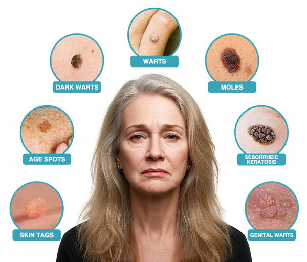 ✨QIAWI™ All-in-One CO₂ Laser Eraser Pen | Removes Moles, Warts, Skin Flaws & Pigmentation（fb）