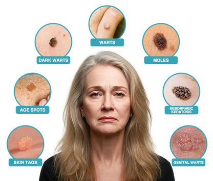 ✨QIAWI™ All-in-One CO₂ Laser Eraser Pen | Removes Moles, Warts, Skin Flaws & Pigmentation（fb）