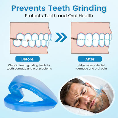 🔥✨PerfectSleep Solution- Anti-Snoring & Anti-Grinding Teeth Protector